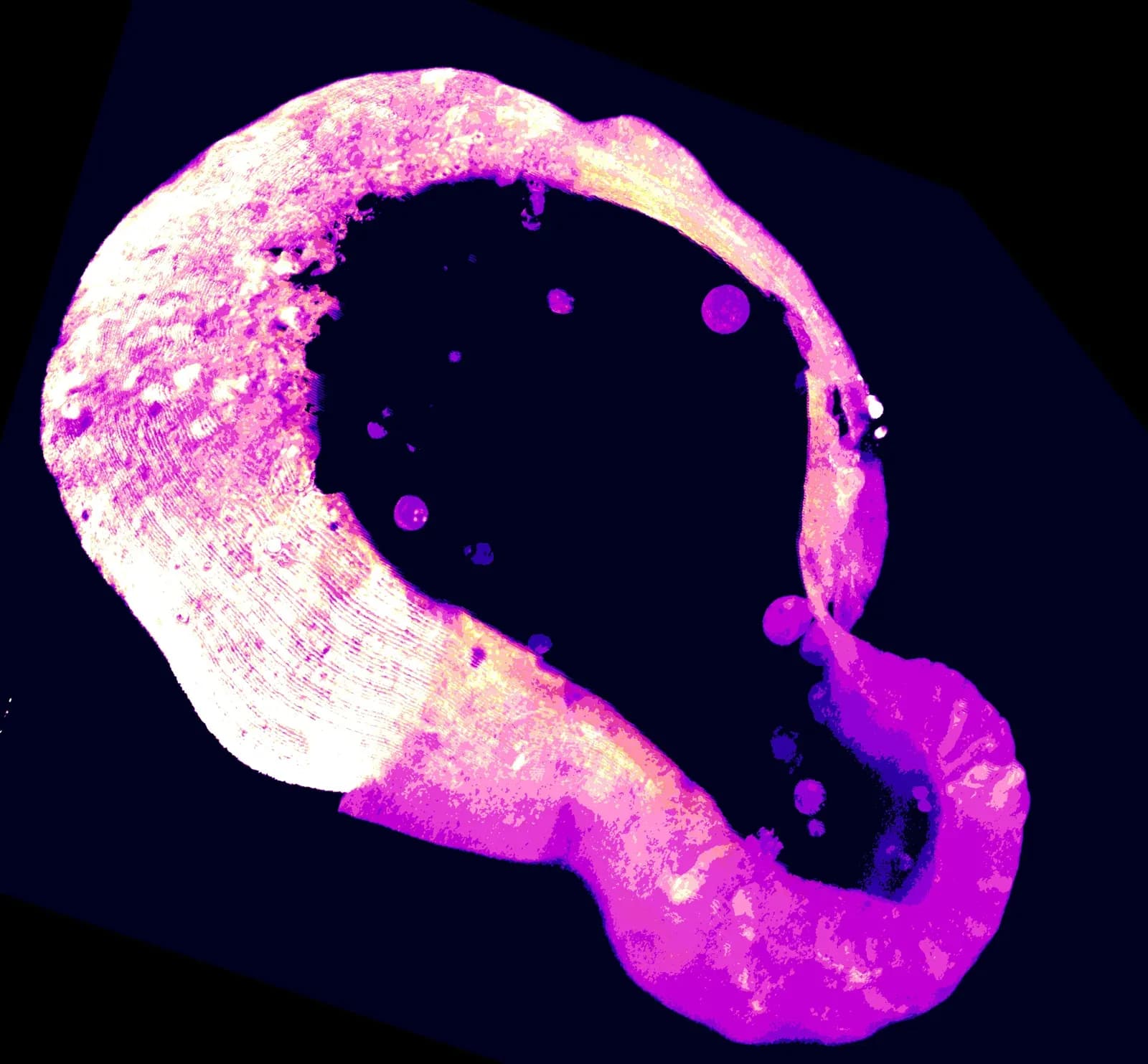 A fluorescence microscopy image of cells glowing in bright magenta and white against a black background.